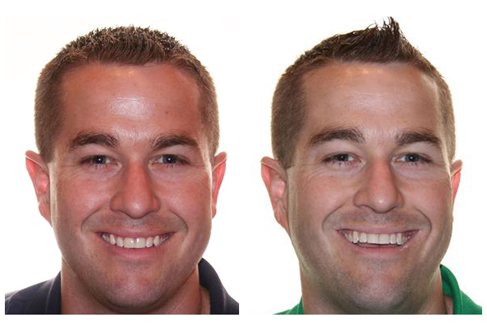 Dr. Anthony Iuvone, DMD