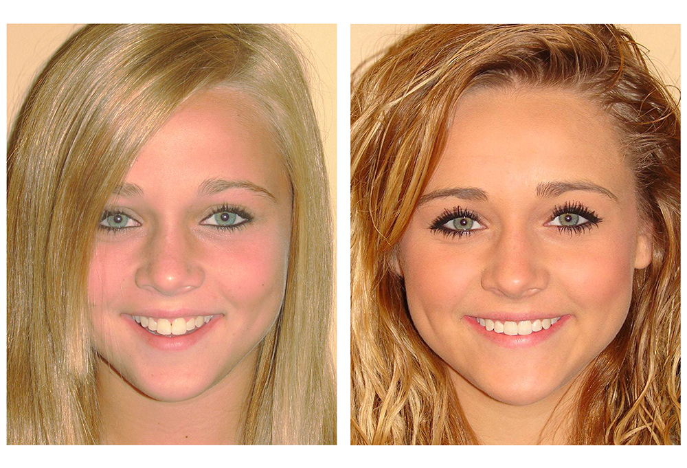 Dr. Anthony Iuvone, DMD