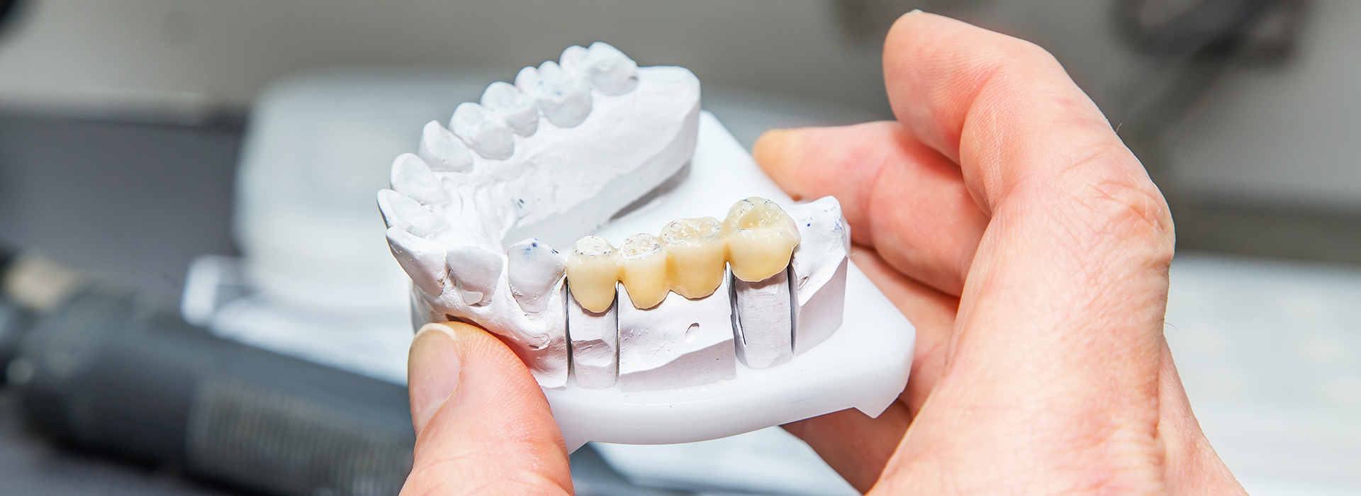 Dr. Anthony Iuvone, DMD | Dental Bridges, Oral Exams and Pediatric Dentistry