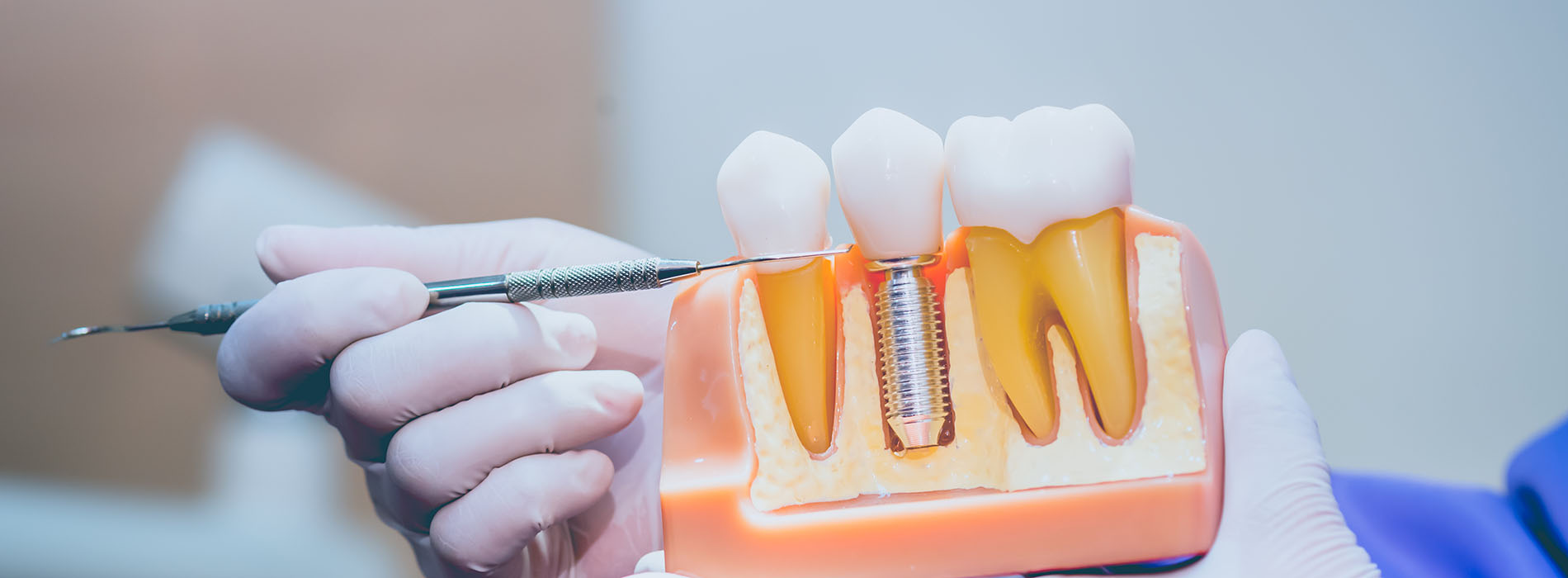 Dr. Anthony Iuvone, DMD | Sedation Dentistry, Crowns and Root Canals