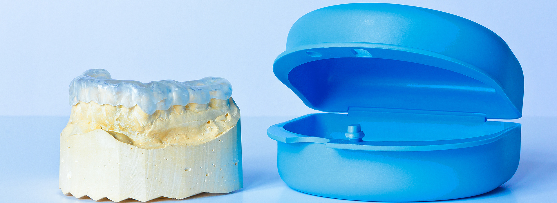 Dr. Anthony Iuvone, DMD | Inlays  amp  Onlays, Crowns and Root Canals