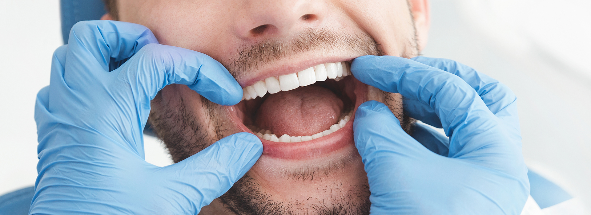Dr. Anthony Iuvone, DMD | Full Mouth Reconstruction, Fluoride Treatment and Root Canals